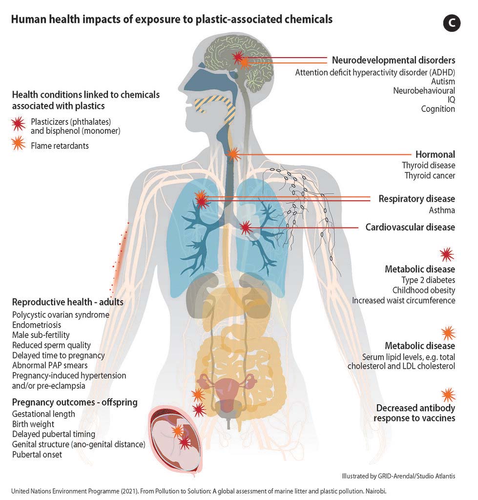 Dr. Branson Ritchie from the University of Georgia coined the term “plasticosis” for plastics-related health issues caused by these microplastics. Illustration courtesy of GRID-Arendal/Studio Atlantis